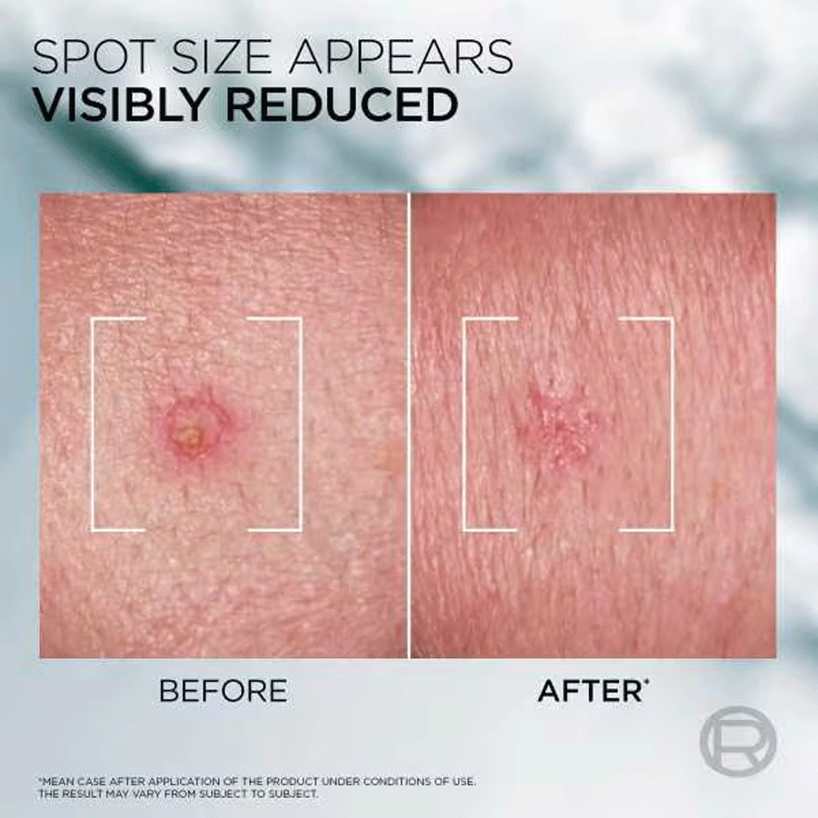 L'Oréal Paris Men Expert Derma Control Pimple Paste 45ml