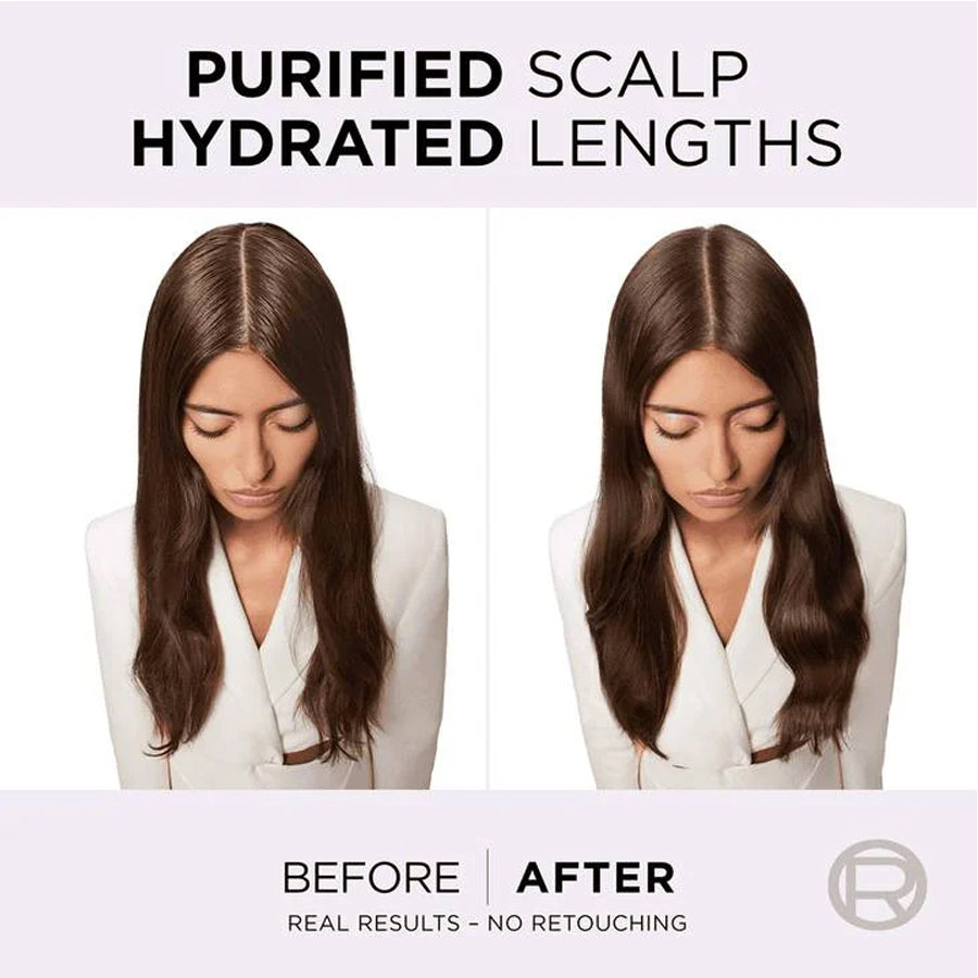 L'Oréal Paris Elvive Hydra Pure Pre-Shampoo Scalp Serum 100ml
