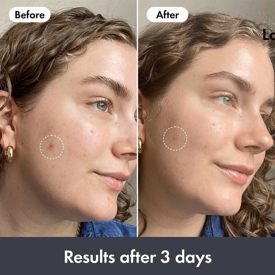 Hero Rescue Balm Original 15ml