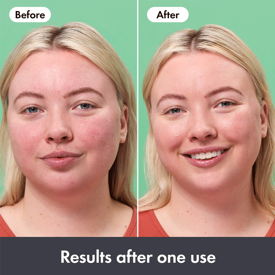 Hero Rescue Balm Red Corrector 15ml