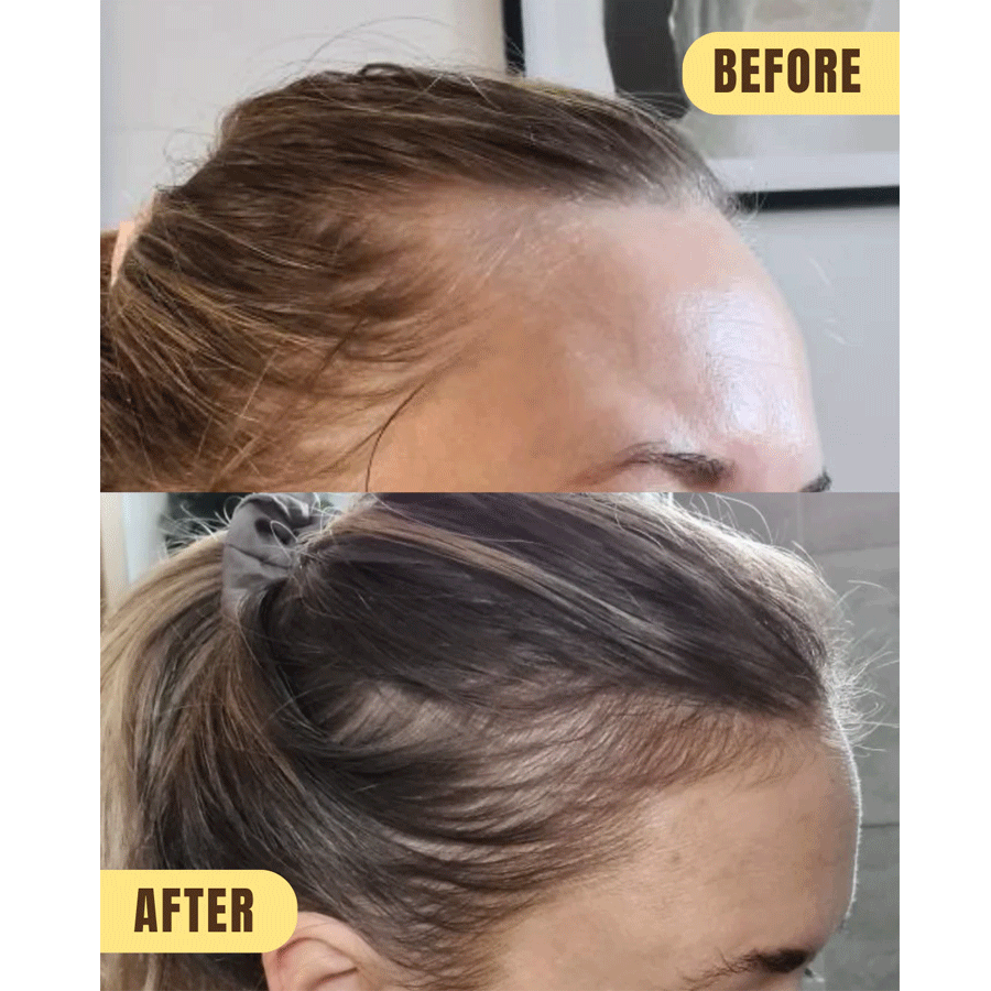 Hair Syrup Grows-Mary Scalp Activating Pre-Wash Oil Treatment 100ml