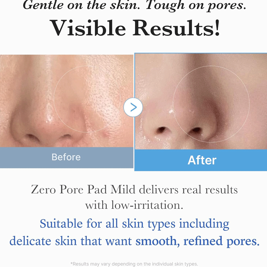 Medicube Zero Pore Pad Mild 155g (70 Pack)