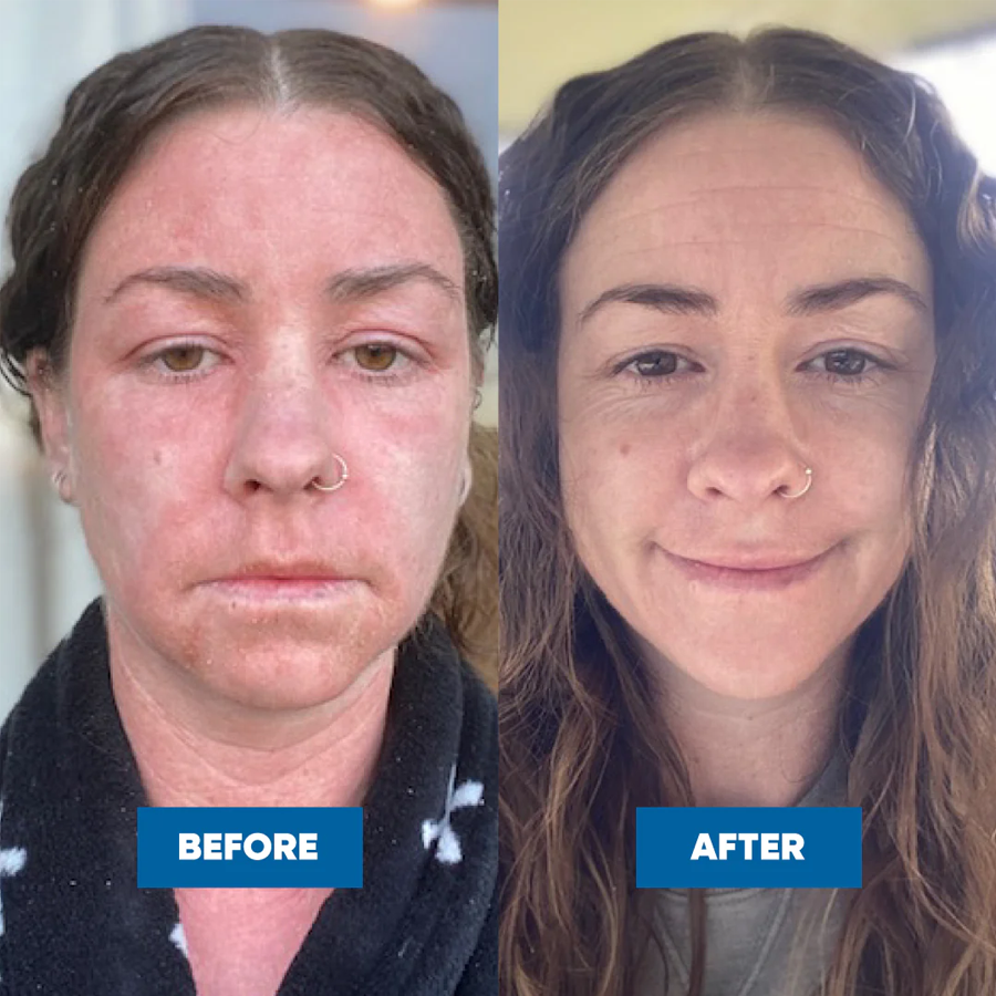 MooGoo Pink Eczema Cream 120g