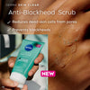 Nivea Derma Skin Clear Anti-Blemish Face Scrub with Salicylic Acid 150ml